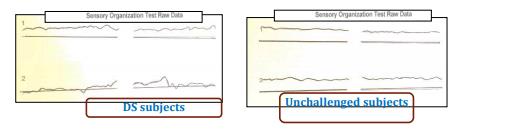 Raw Data results in a DS subject and an unchallenged subject (example)